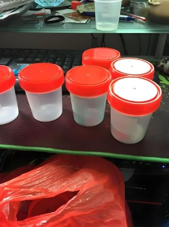medical injection molding medical injection molding